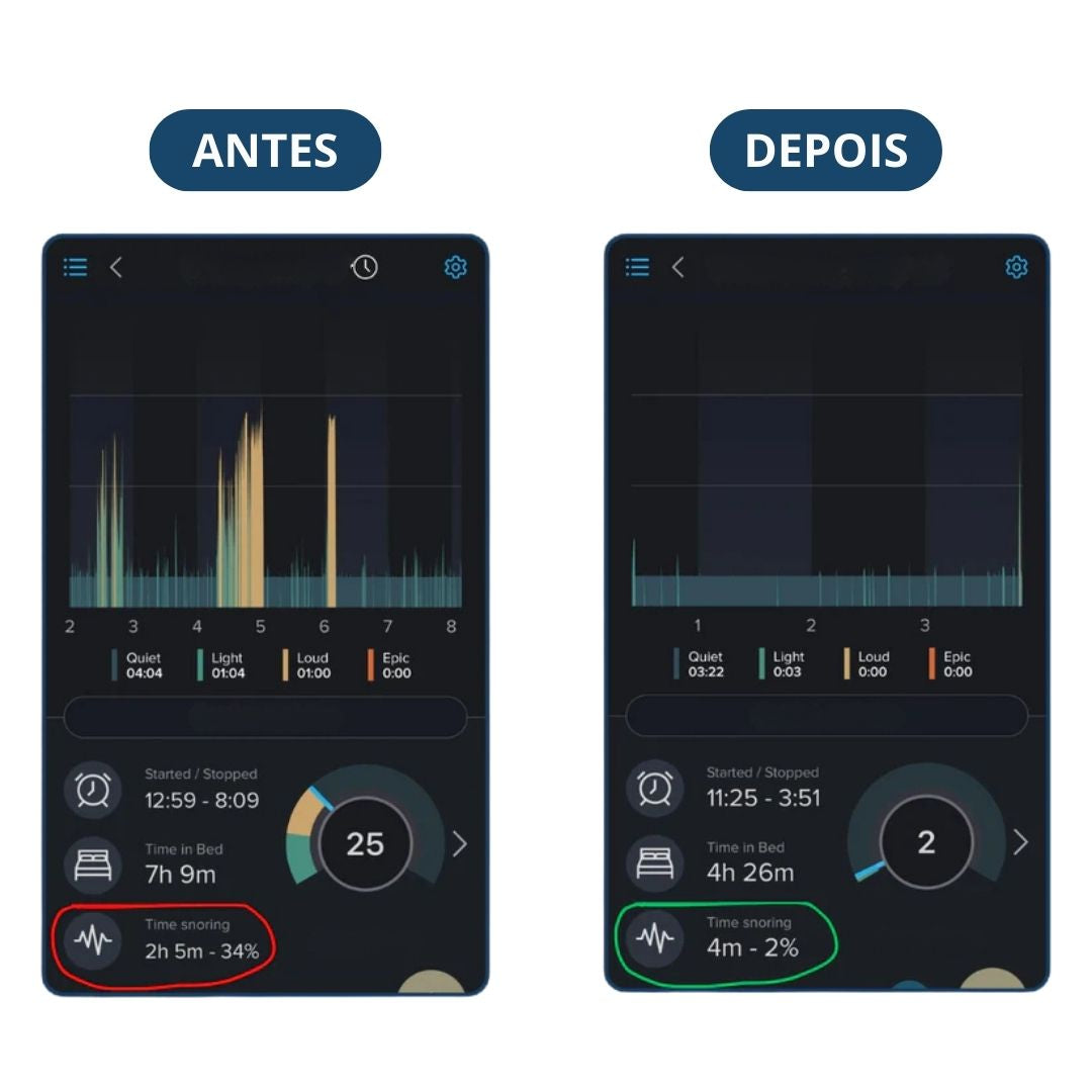 Silentek® Anti-Ronco Inteligente EMS