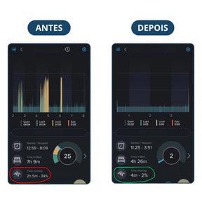 Silentek® Anti-Ronco Inteligente EMS